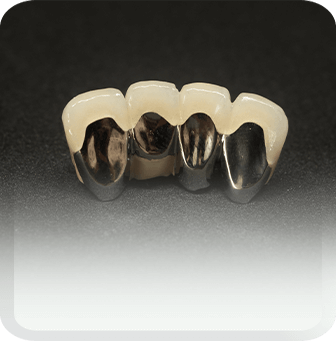 dental crowns type